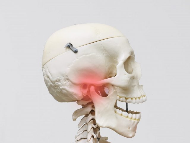 肩こり、首こりの原因は顎関節症が原因かも！？顎関節症の種類と治療法